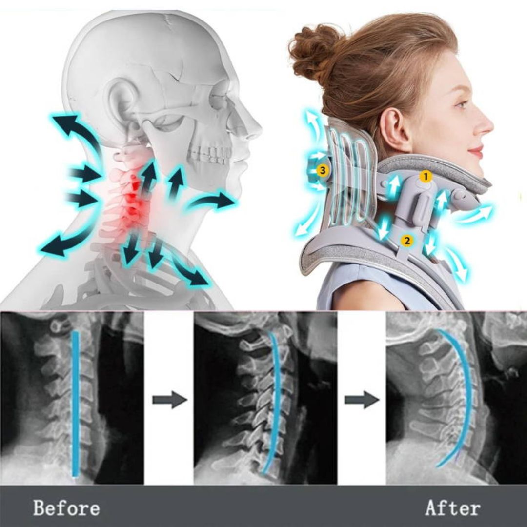 Adjustable Neck Traction Device for Cervical Pain and Tension Relief