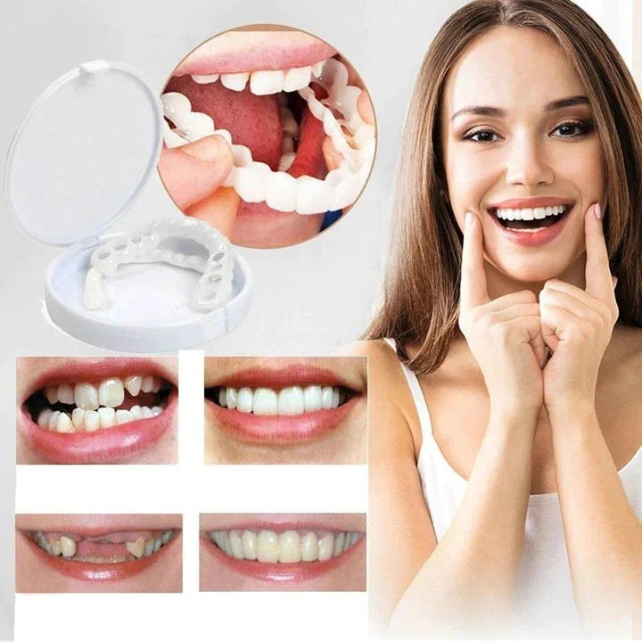 Instant Smile Makeover with Snap-On Veneers