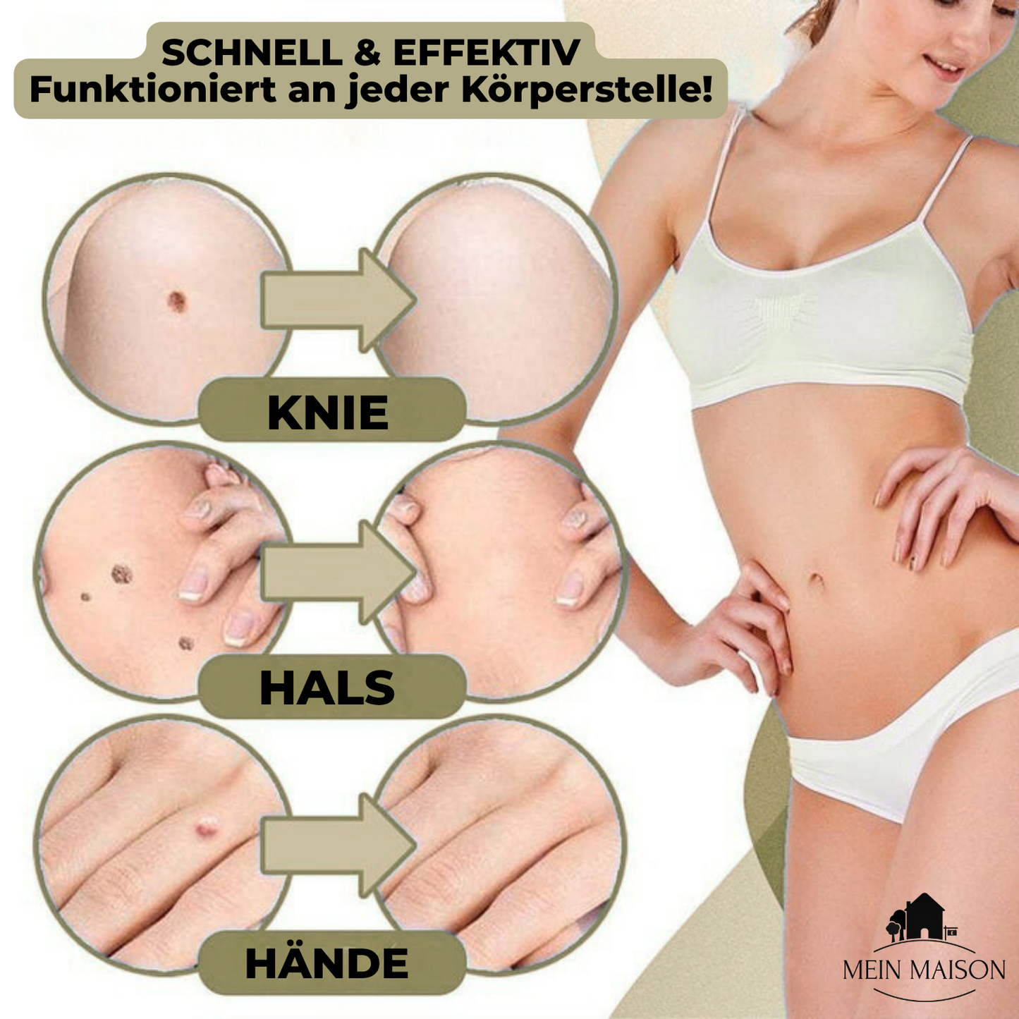 Pain-Free Wart & Mole Remover for Home Use | No Surgery Needed