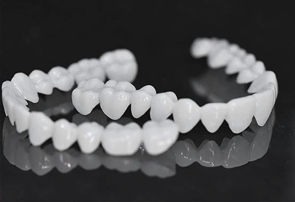 Dental Veneers for a Natural Fit and Comfortable Smile